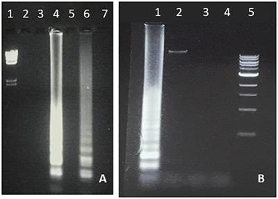 Loop-Mediated Isothermal Amplification (LAMP) as a Rapid, Affordable and Effective Tool to Involve Students in Undergraduate Research